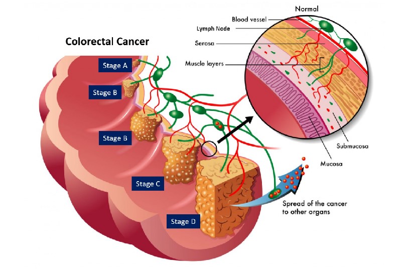 Lofent Water Ionizer